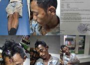 Masih Satu Tersangka Ditangkap, Polsekta Medan Labuhan Belum Menangkap Tersangka Lain Penganiayaan Irrudi pada Mei 2023 Lalu