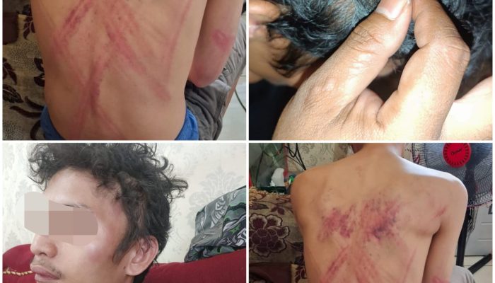 Nama Pelaku Penculikan dan Penganiayaan Krisman Sudah Dikantongi Polisi, Saksi Sudah Diperiksa