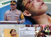 Hampir Setahun 8 Pembegal 4 Pelajar Tak Tertangkap, Ini Kata Kapolrestabes Medan