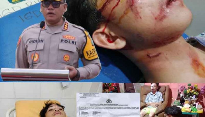Hampir Setahun 8 Pembegal 4 Pelajar Tak Tertangkap, Ini Kata Kapolrestabes Medan