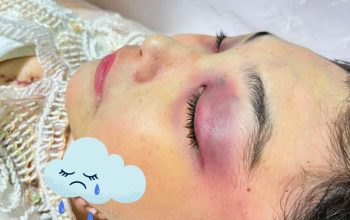 Kematian Winda Lorenza Gowasa Janggal, LBH Medan Menduga Kematian nya Bukan Bunuh Diri, Melainkan Adanya Dugaan Tidak Pidana