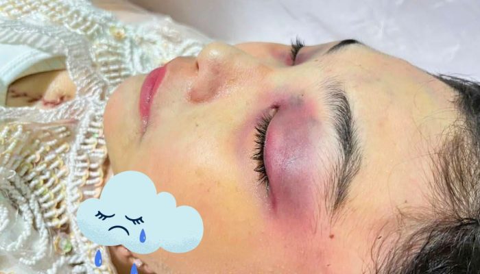Kematian Winda Lorenza Gowasa Janggal, LBH Medan Menduga Kematian nya Bukan Bunuh Diri, Melainkan Adanya Dugaan Tidak Pidana